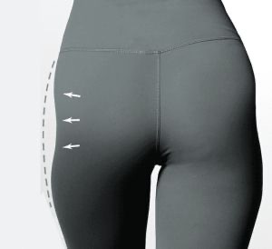 فیلر ناحیه هیپ دیپ