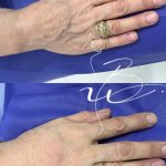 فیلردست درمشهد