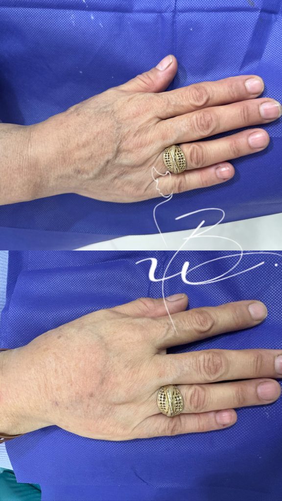 فیلردست درمشهد