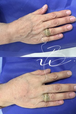 فیلردست درمشهد